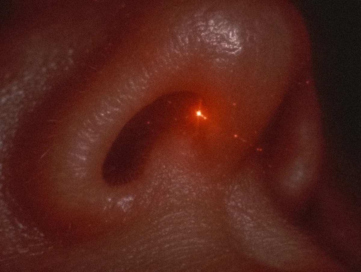 Modernes Lasergerät